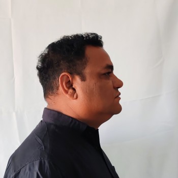 Right side face